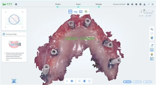 Ki jan yo ekspòte fichye STL dirèkteman nan optik Entraoral pou enprime 3D
